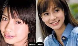 娱乐圈爆料卡通牙套,卡通牙套引领娱乐圈新潮流